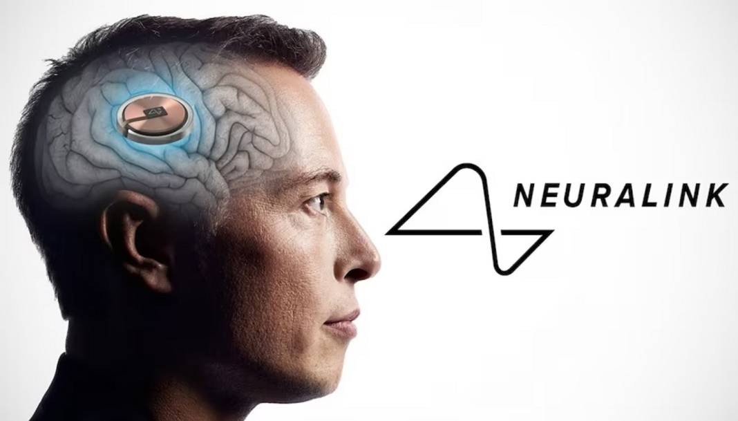 Elon Musk'un projesi Neuralink nedir? Neuralink ne işe yarayacak 7